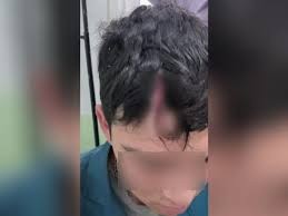 Inseguridad en Chimbas: golpearon salvajemente a un adolescente que iba a la escuela en un intento de robo