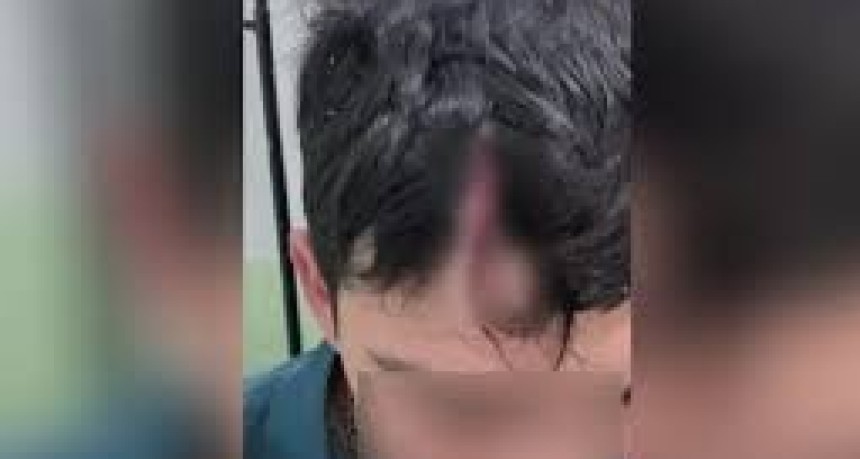 Inseguridad en Chimbas: golpearon salvajemente a un adolescente que iba a la escuela en un intento de robo