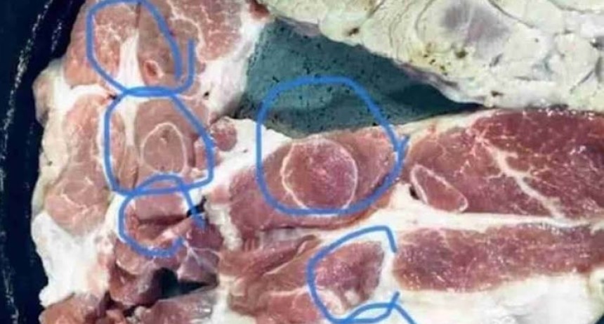 Triquinosis: síntomas, cómo prevenirla y recomendaciones clave para un consumo seguro de carne de cerdo